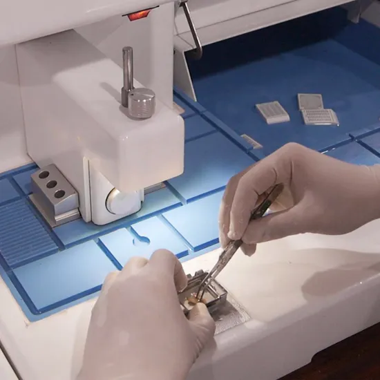 埋め込みセンターマシン医療xレイ聴覚聴覚計の血液グルコースメーターモニターポータブル分析埋め込みセンター